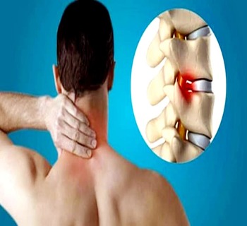 Treatment of Cervical Pain with Homeopathy 